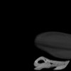 SPORK, NICO - 22.03.1976 - 02.08.2022 - CT obere Extremität - 17:59:38